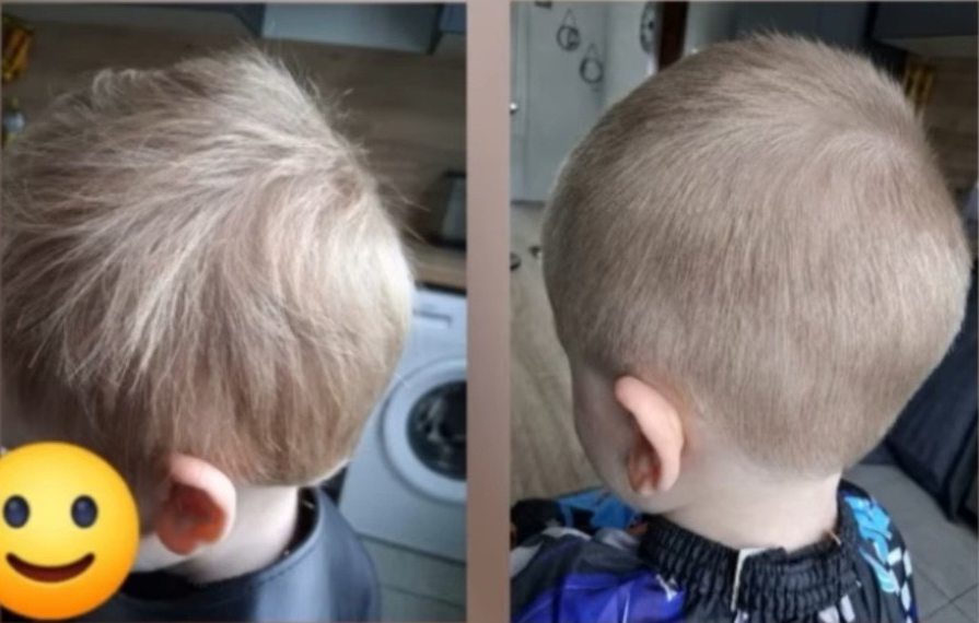 Coupe enfant de Maël, avant et après